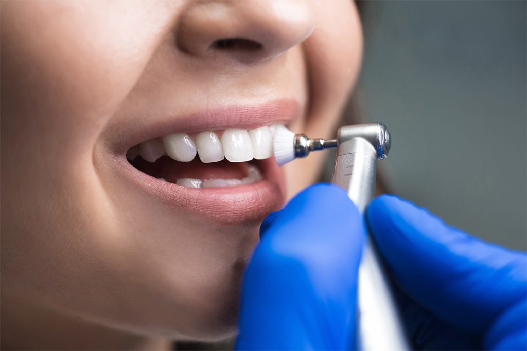 Why Preventive Dentistry Matters: Safeguarding Your Smile with GladeWater Family Dental